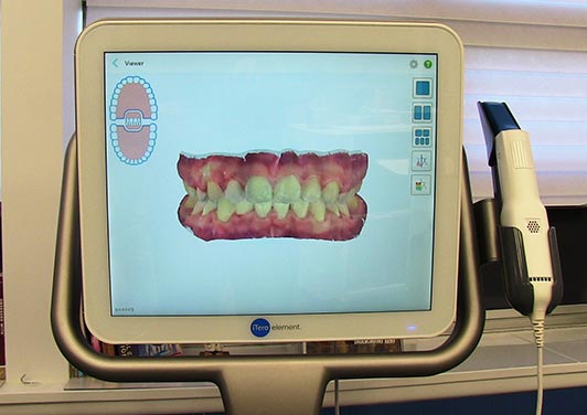 dentist office monitor | Dr. Gallois Orthodontics